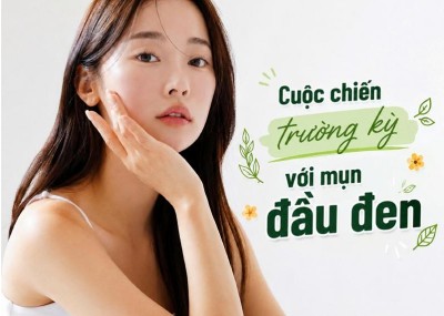 Cuộc chiến trường kỳ với mụn đầu đen