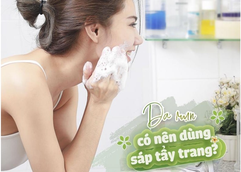 Da mụn có nên dùng sáp tẩy trang?