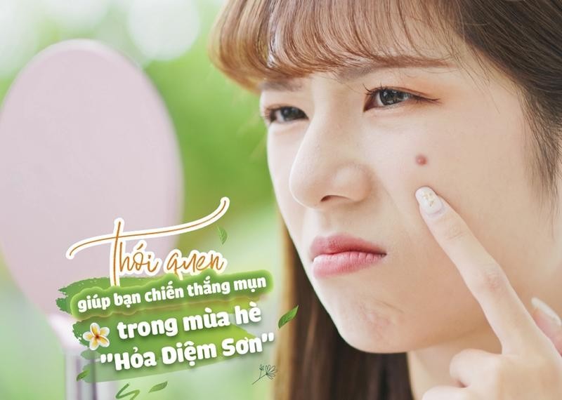 Thói quen giúp bạn chiến thắng mụn trong mùa hè "hỏa diệm sơn"