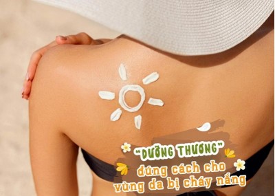 “Dưỡng thương” đúng cách cho vùng da bị cháy nắng 