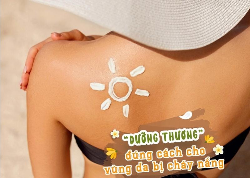 “Dưỡng thương” đúng cách cho vùng da bị cháy nắng 
